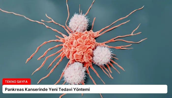 Pankreas Kanserinde Yeni Tedavi Yöntemi